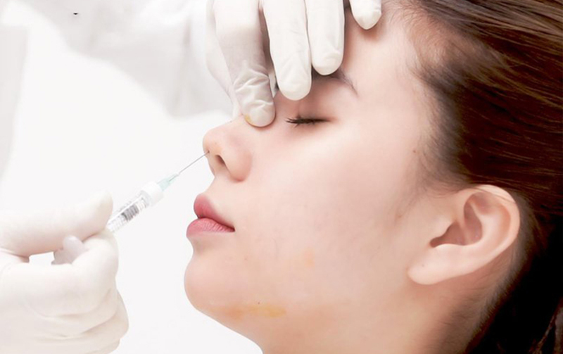 Bạn có thể làm đẹp bằng phương pháp tiêm filler mũi khi con hơn 6 tháng tuổi