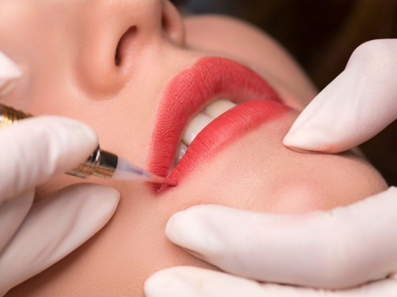 Cấy môi sinh học có thể gây ra cảm giác đau một chút, tùy vào cơ địa
