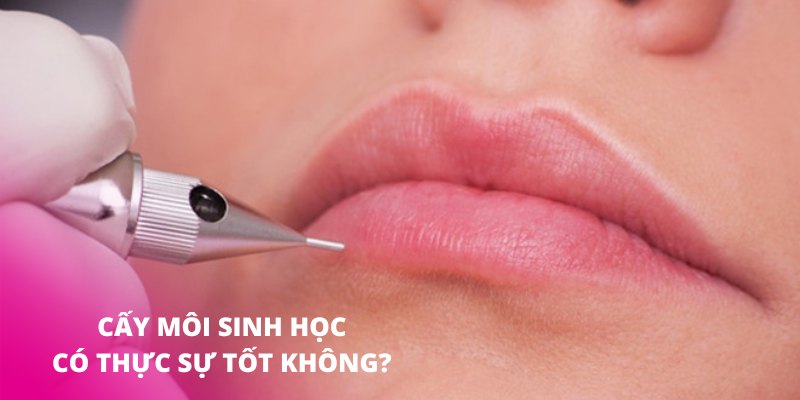 Thực hiện kỹ thuật cấy môi sinh học có tốt hay không?