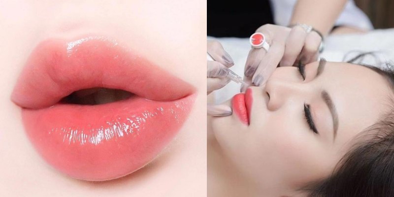 Bầm môi sau khi xăm có thể do vỡ mạch máu