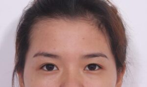 Đôi mắt có nếp gấp mí không rõ ràng, bị sụp mí trên