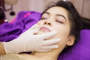 Trước khi tiêm filler môi, khách hàng sẽ được ủ tê để không gây cảm giác đau