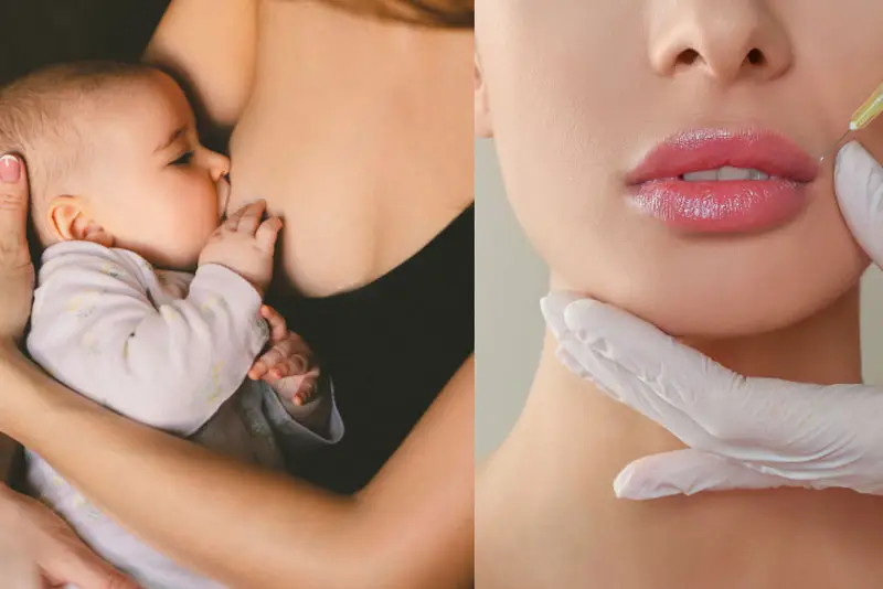 Có bầu tiêm filler được không: khuyến cáo từ bác sĩ thẩm mỹ