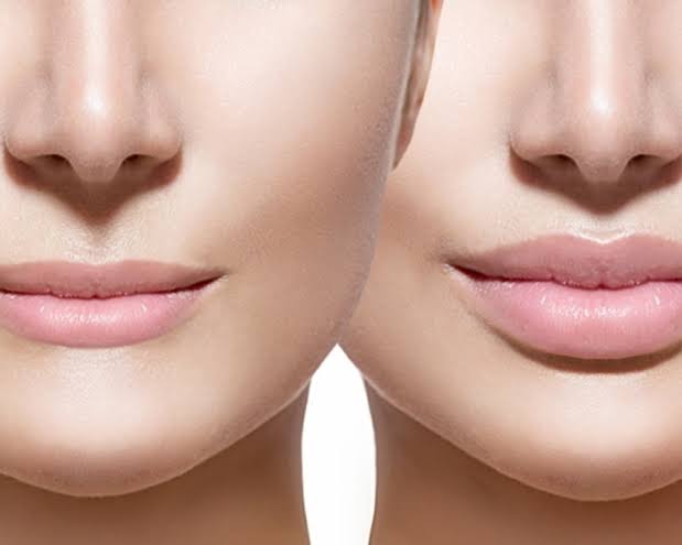 Cắt môi bằng laser ít chảy máu, không cần khâu và hồi phục nhanh, còn phương pháp mổ truyền thống có ưu điểm về chi phí tiết kiệm hơn.