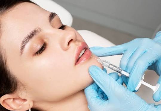 Tiêm filler môi bao lâu thì tan? Yếu tố ảnh hưởng thời gian duy trì