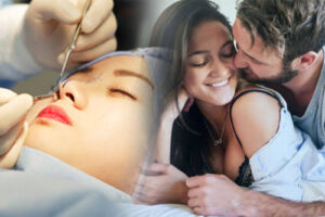 Nâng mũi bao lâu được quan hệ: hướng dẫn an toàn từ bác sĩ