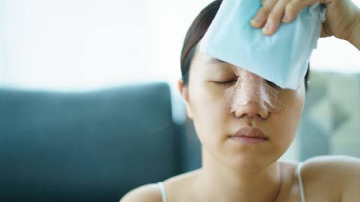 Chườm lạnh đúng cách trong 48 giờ đầu (10–15 phút/lần, 4–6 lần/ngày qua khăn mỏng) giúp co mạch và giảm phù nề hiệu quả, tránh chườm quá 20 phút để không gây thiếu máu nuôi mô.