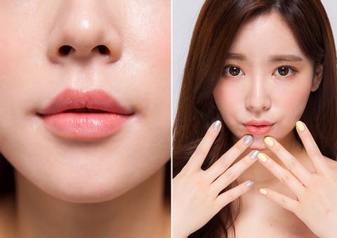 Cắt môi dày thành mỏng: quy trình, hồi phục và những lưu ý quan trọng