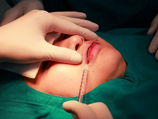 Chi phí cắt môi dày tại Việt Nam thường dao động từ 5 đến 15 triệu đồng tùy thuộc vào tay nghề bác sĩ, cơ sở y tế và kỹ thuật thực hiện.