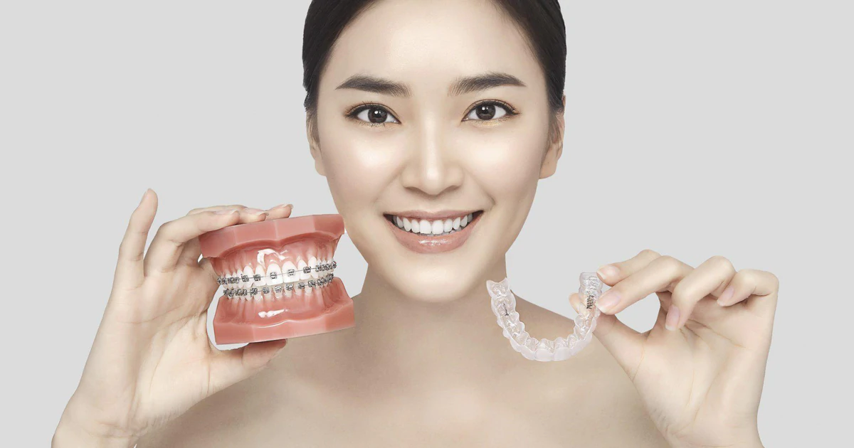 Niềng răng không làm thay đổi cấu trúc mũi, sống mũi trông cao hơn chỉ là hiệu ứng thị giác từ góc nghiêng.