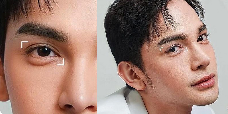 Đánh giá khách hàng khách quan qua hình ảnh trước sau nhiều góc độ và tiến trình hồi phục thực tế.