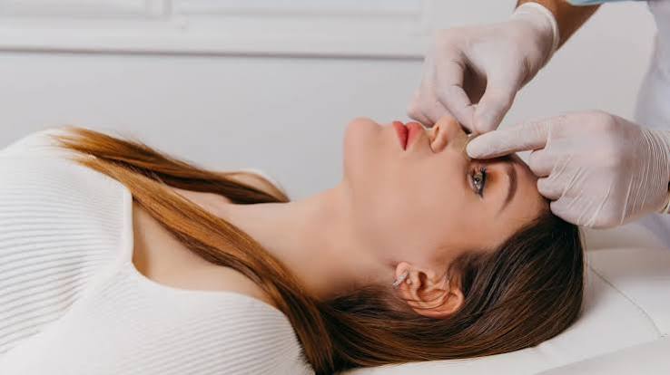 Các mức xử trí nhiễm trùng nâng mũi gồm điều trị kháng sinh, làm sạch dẫn lưu mủ, rút sụn và phẫu thuật tái tạo.