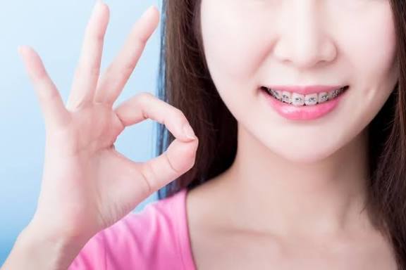 Đang niềng răng vẫn nâng mũi được bình thường, nhưng cần tránh thời điểm siết răng mạnh và thông báo cho bác sĩ phẫu thuật.