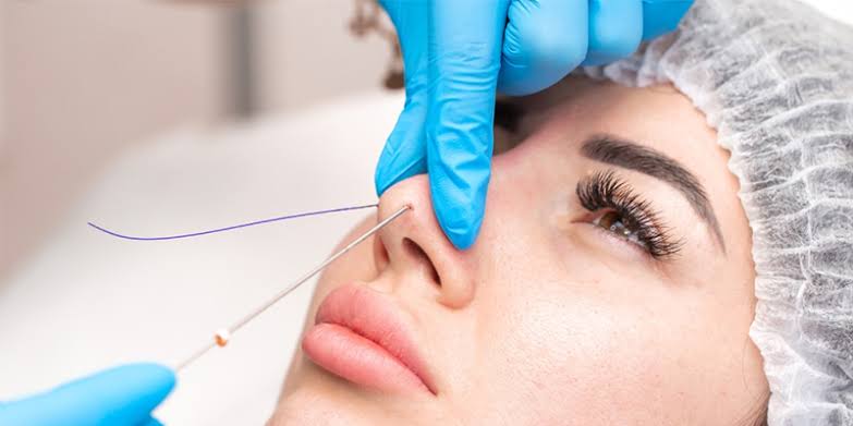 Nâng mũi gì an toàn nhất: nên chọn sụn nào, bao lâu hồi phục?