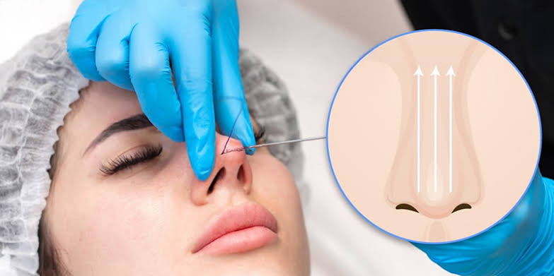 Chi phí nâng mũi phụ thuộc phương pháp phẫu thuật, tay nghề bác sĩ, chất liệu sụn và tình trạng mũi thực tế.