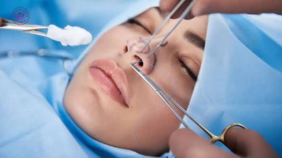 Bác sĩ tiến hành vô cảm, bóc tách đặt sụn, cân chỉnh trụ sống mũi và khâu đóng vết mổ thẩm mỹ.