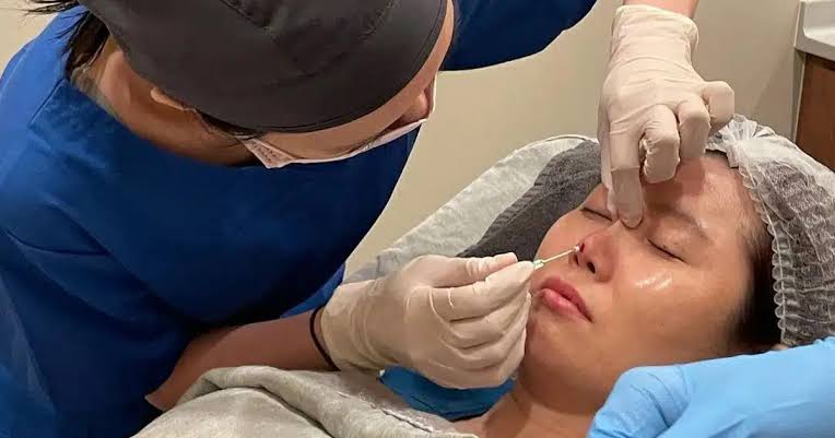 Quy trình phòng mổ gồm vô cảm, vô trùng đánh dấu, phẫu thuật tạo hình và khâu nẹp cố định an toàn.