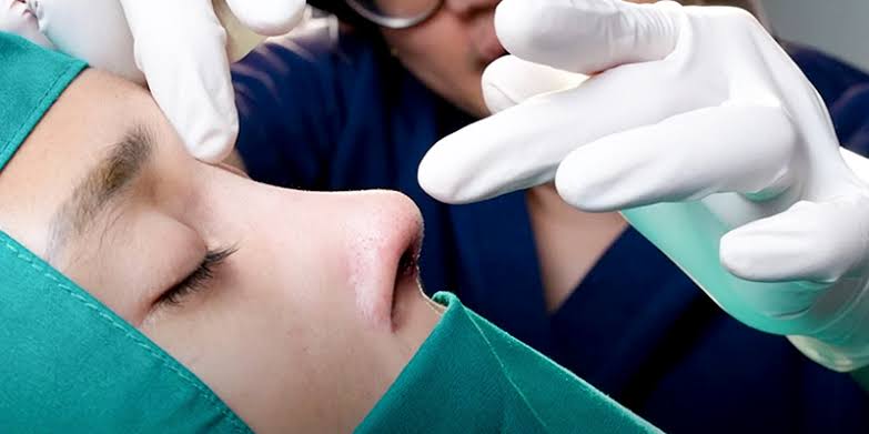 Thao tác rút ống nâng mũi thường diễn ra sau 24–48 giờ tại cơ sở y tế nhằm đảm bảo an toàn vết thương.