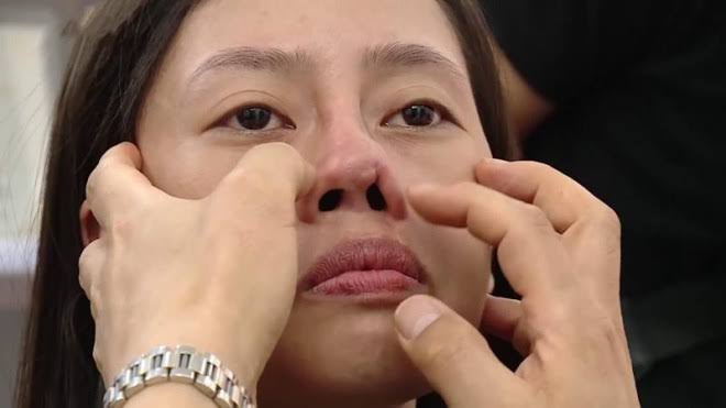 Tái khám ngay nếu chảy máu liên tục, đau nhức tăng hoặc sốt và tiết dịch hôi sau rút ống.