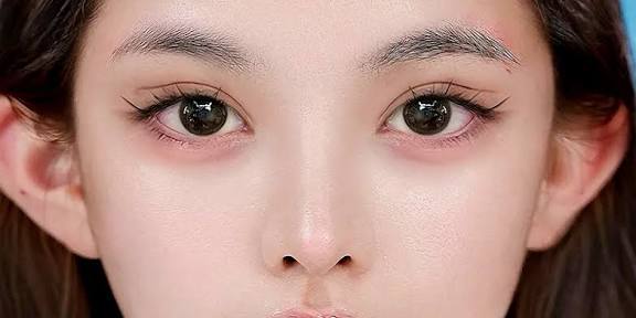 Cắt mí cánh tiên an toàn khi bác sĩ chuyên khoa thực hiện đúng kỹ thuật trong môi trường vô trùng tuyệt đối.
